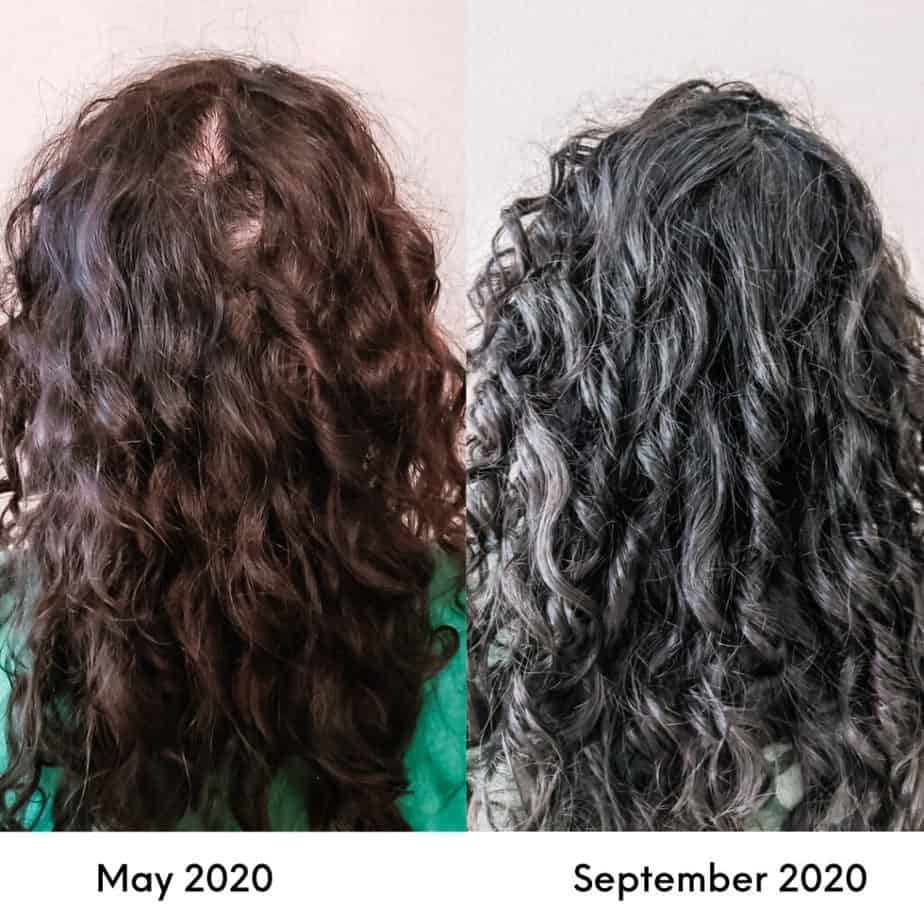 Hair Loss and the Curly Girl Method: How To Address Thinning Curly