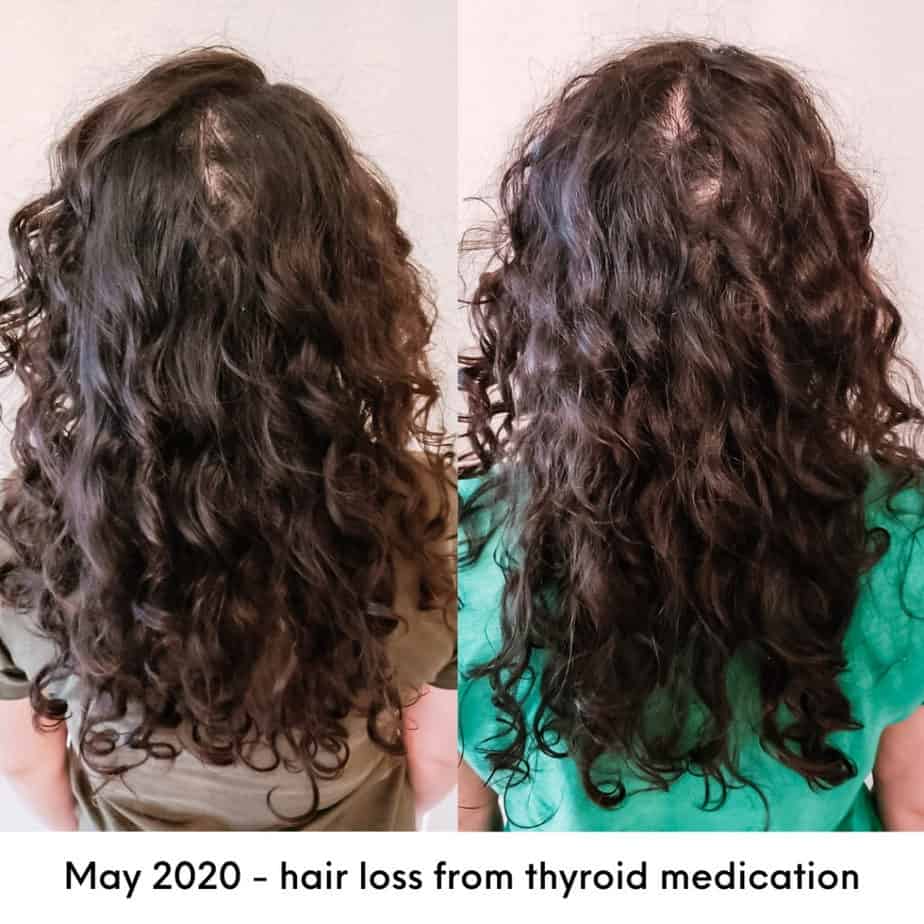 thinning curly hair