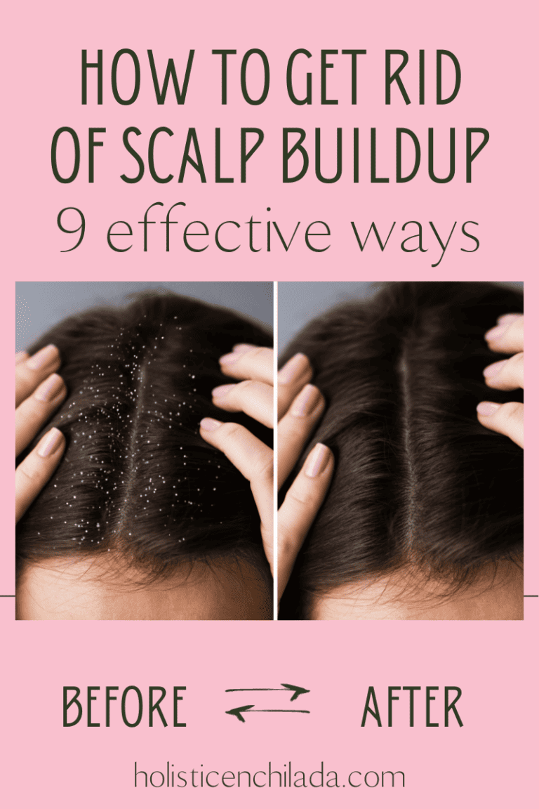 How To Get Rid of Scalp Buildup: 9 Effective Ways